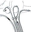 Parts diagram for cabling